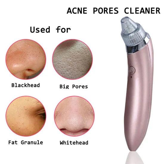 Electric Blackheads Remover Beauty Tool