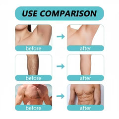 ECRIN Hair Removal Foaming Spray – Fast-Acting Body Hair Remover with Refreshing Fragrance | 200ml